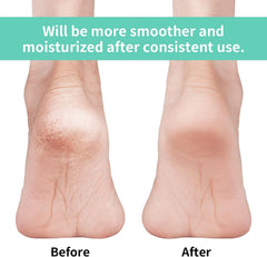 Toeless moisturizing heel sleeve with gel lining worn on a foot